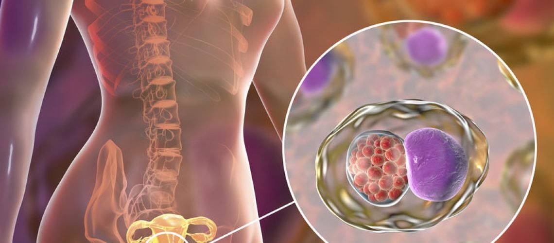 Câncer do colo do útero: metabolismo 'turbinado' na borda do tumor explica avanço mais agressivo  