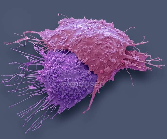 Genoma do câncer no Brasil revela mapa inédito de risco e herança genética  