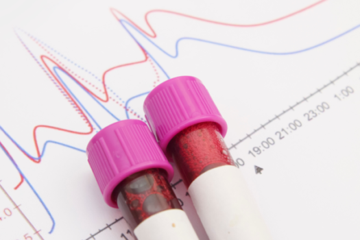 Atlas inédito do câncer do sangue revela diferenças biológicas entre leucemia infantil e adulta