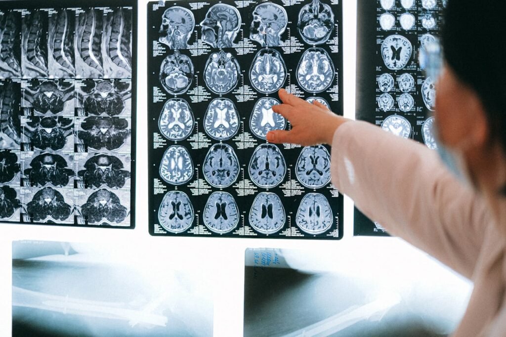 Inflamação Invisível: estudo revela que artrite juvenil pode deixar marcas duradouras no cérebro 
